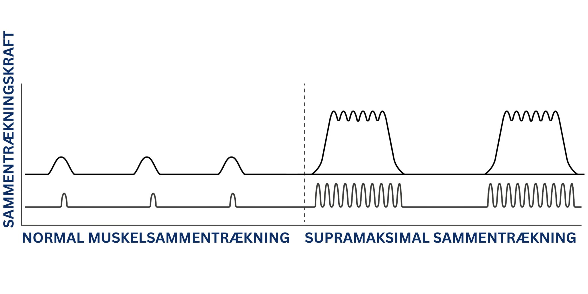 Illustration af normal og supramaksimal muskelsammentrækning ved Pelvic Chair
